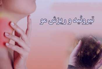 پرکاری تیروئید و ریزش مو , علایم پرکاری تیروئید , تیروئید و ریزش مو پرکاری تیروئید و ریزش مو , علایم پرکاری تیروئید , تیروئید و ریزش مو