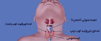 پرکاری تیروئید در کودکان , رژیم غذایی پرکاری تیروئید در کودکان , درمان پرکاری تیروئید در کودکان پرکاری تیروئید در کودکان , رژیم غذایی پرکاری تیروئید در کودکان , درمان پرکاری تیروئید در کودکان