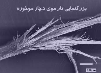 سرکه در درمان موخوره , خواص سرکه برای موخوره , سرکه سیب در درمان موخوره سرکه در درمان موخوره , خواص سرکه برای موخوره , سرکه سیب در درمان موخوره
