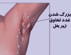 بیماری خراش گربه, انواع بیماری, زندگی مشترک با حیوانات