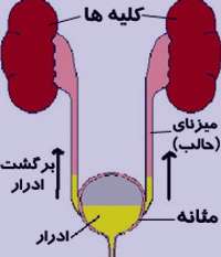 عفونتهاي ادراري, علائم ريفلاکس ادراري