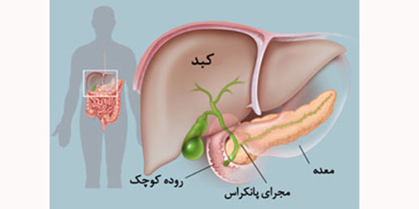 سرطان پانکراس , سرطان پانکراس بدخیم , سرطان پانکراس خوش خیم , سرطان پانکراس چیست سرطان پانکراس , سرطان پانکراس بدخیم , سرطان پانکراس خوش خیم , سرطان پانکراس چیست