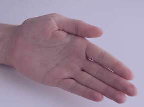 خارش کف دست همیشه مژده پول نیست