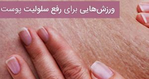 علت و درمان خانگی سلولیت پوست صورت و ران چیست