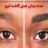 از ابتدا تا نتیجه نهایی: مسیر تجربه کسانی که کاشت ابرو انجام داده‌اند