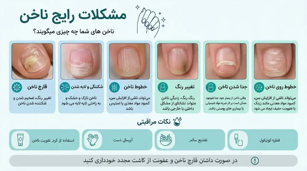 مراقبت های کاشت ناخن