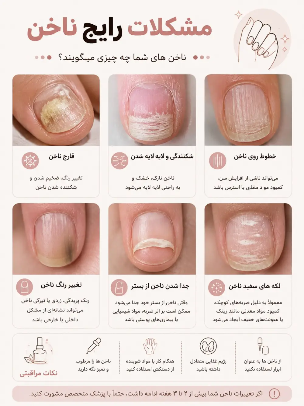 قارچ ناخن